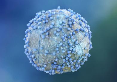 A pancreatic cancer cell